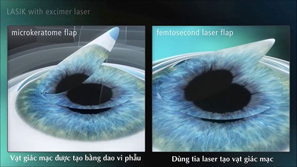 femtosecond laser