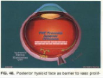 NHỮNG BIẾN CHỨNG THƯỜNG GẶP CỦA MỔ ĐỤC THỦY TINH THỂ