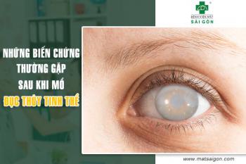 Femtosecond laser – chữa tật khúc xạ nhanh, an toàn, hiệu quả